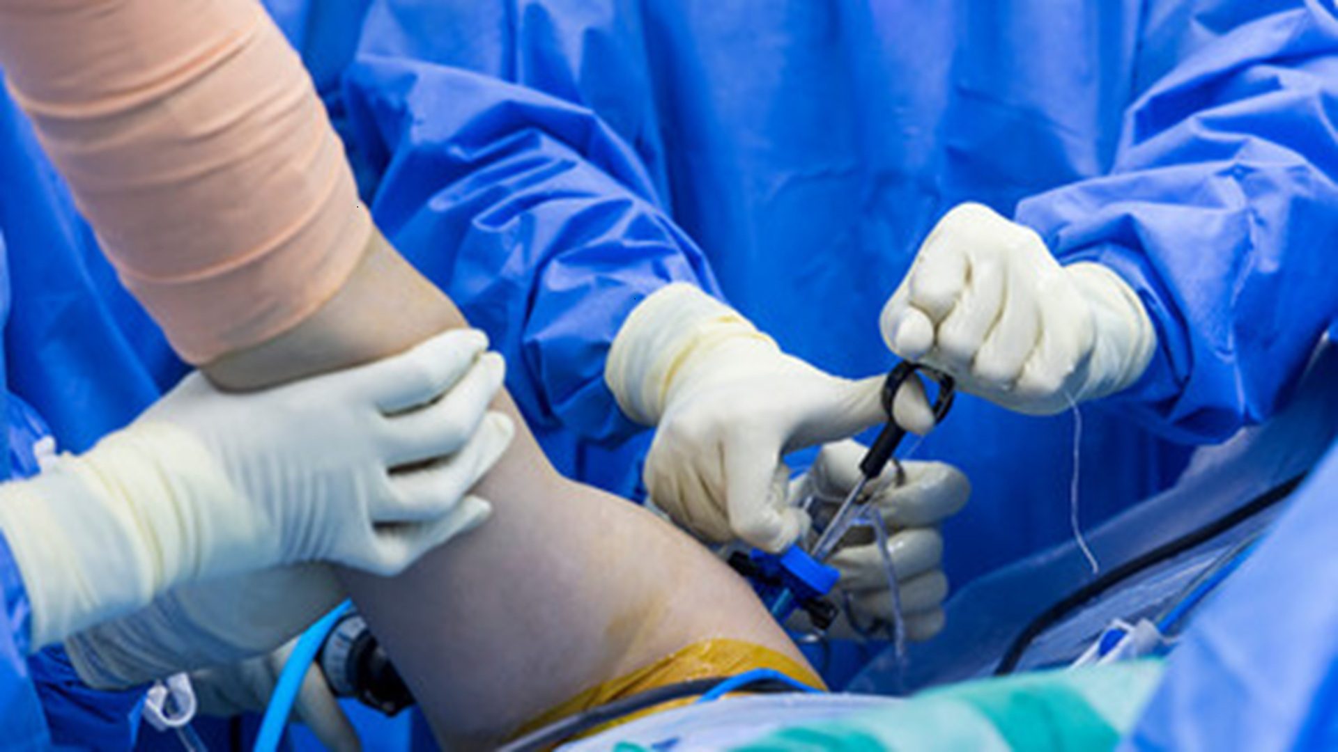 Shoulder replacement surgery