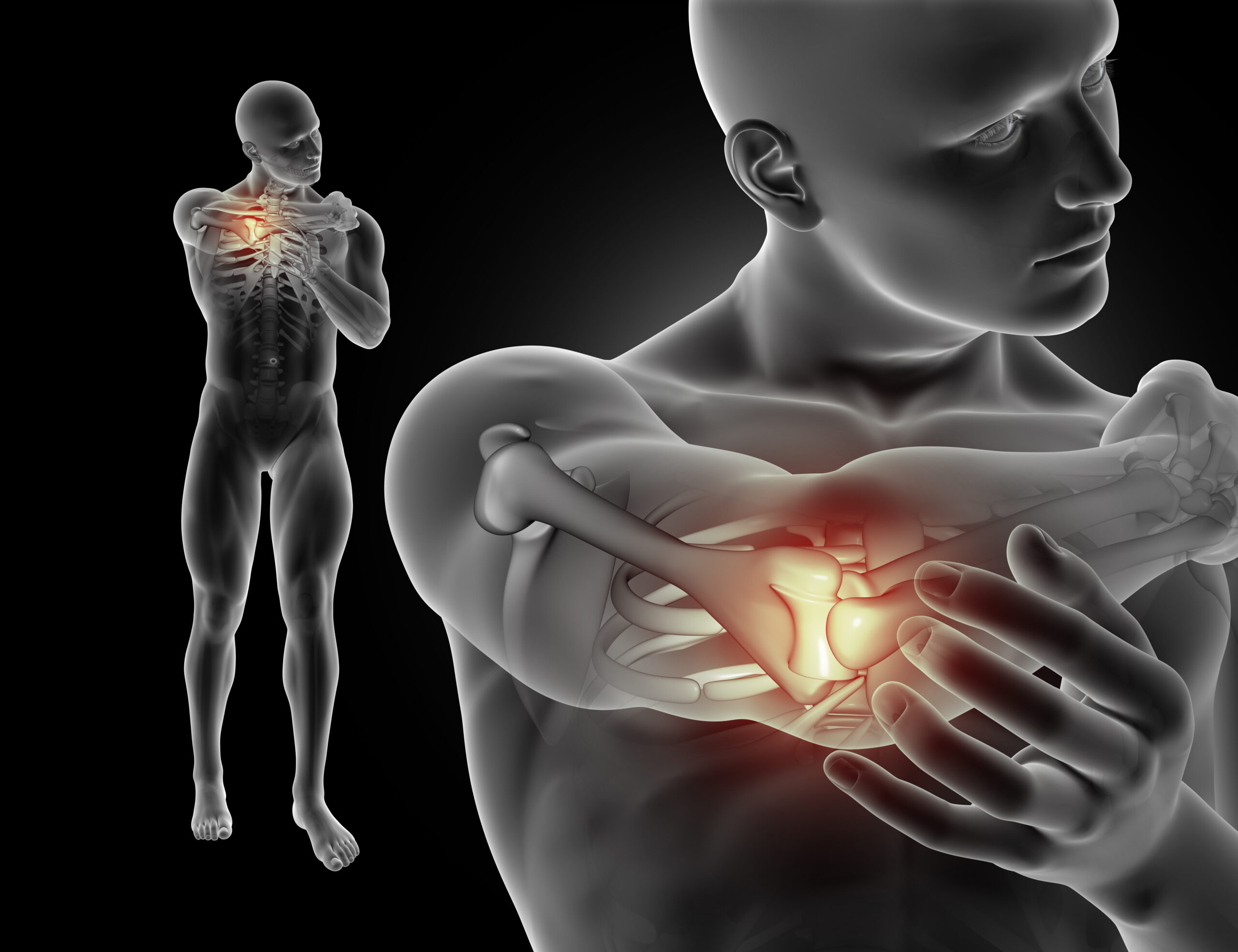 joint pain