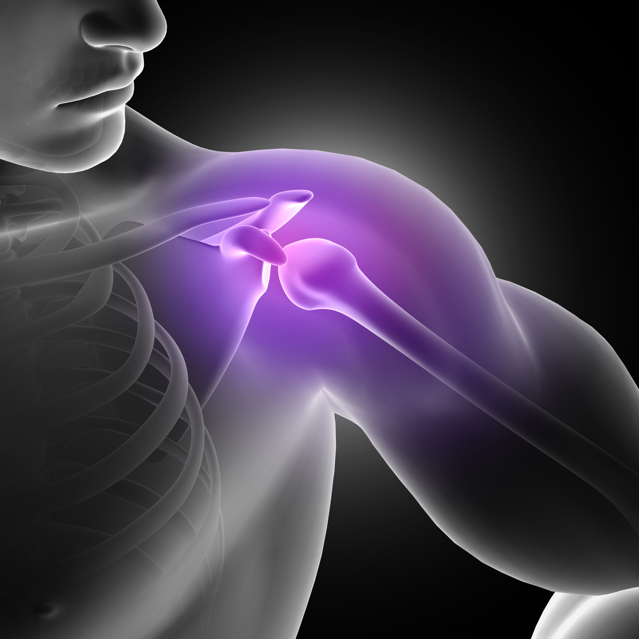 joint pain