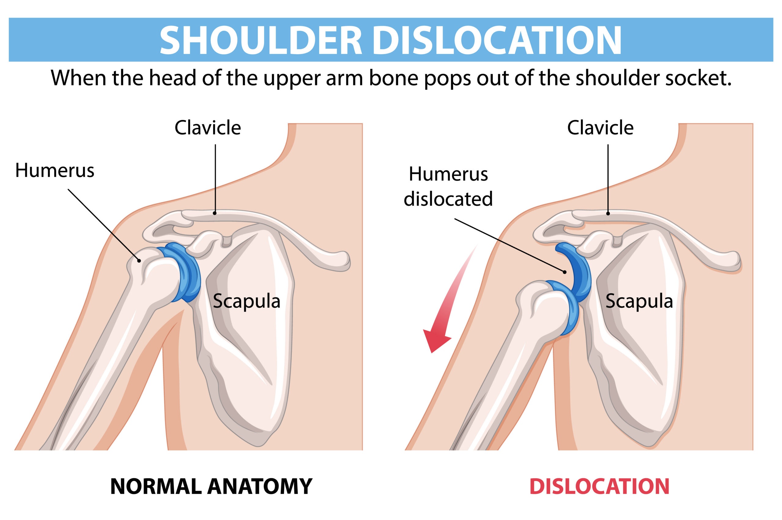 Shoulder Clicking