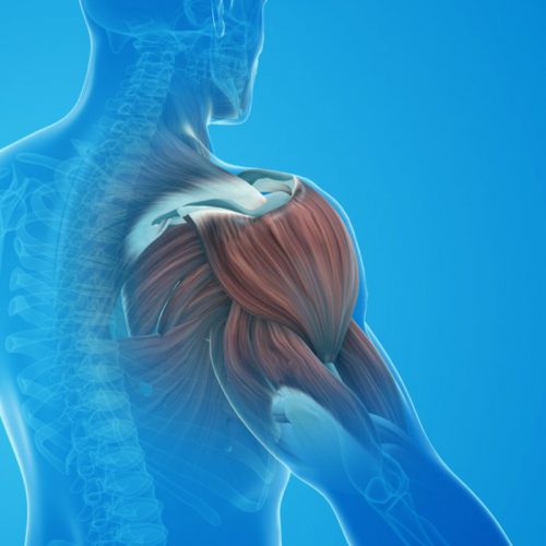 Image of frozen shoulder